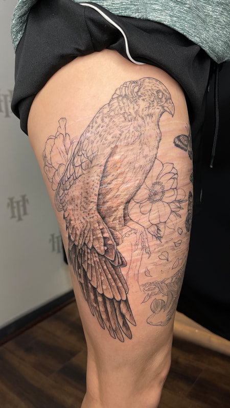 Right thigh final elements lined and healed