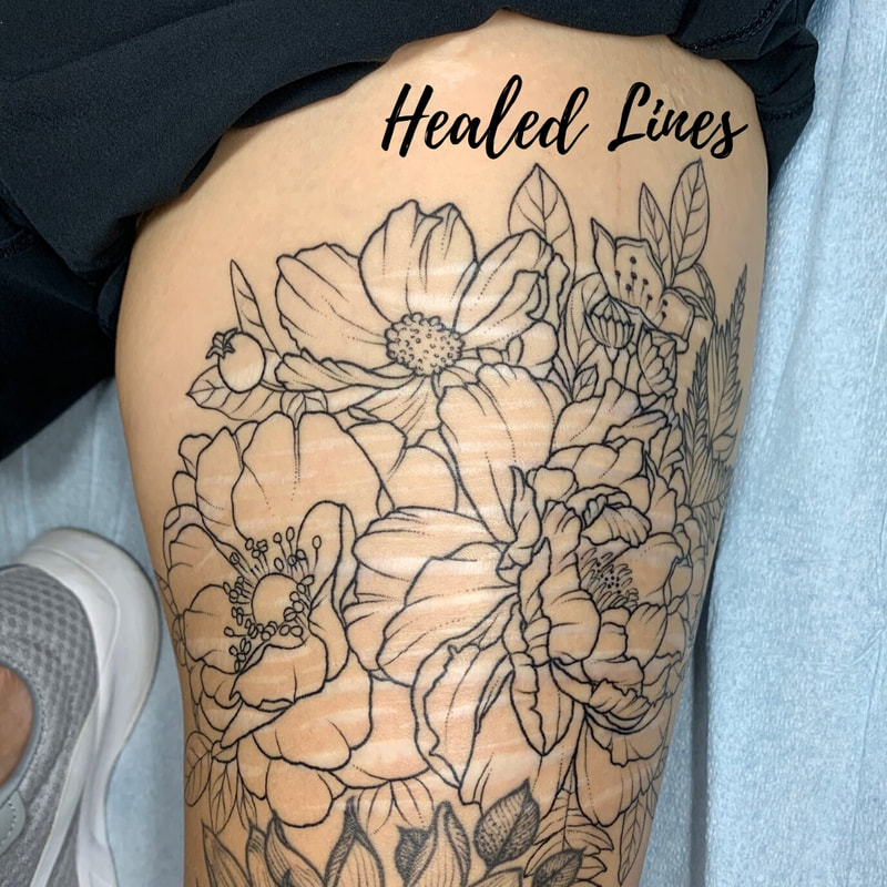 Left thigh - healed lines